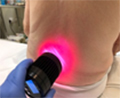 Αντιαλγικό Ψυχρό Laser (LLLT)