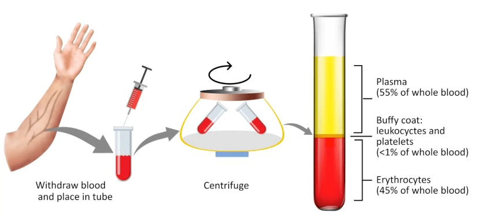 Θεραπεία με PRP (Platelet Rich Plasma)