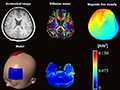 tDCS (Transcranial Direct Current Stimulation)