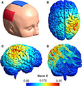 tDCS (Transcranial Direct Current Stimulation)